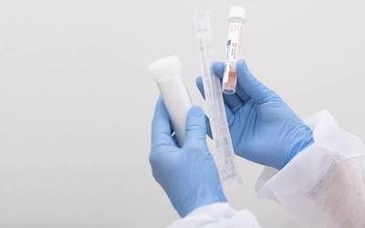 Kasu positibo bat zenbatu du Osasun Sailak PCR probetan