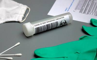 Lau kasu positibo atzeman ditu Osakidetzak Elgoibarren azken PCR probetan