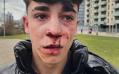 Kartzela zigorrak eta inhabilitazioa eskatu dituzte bi udaltzainentzat