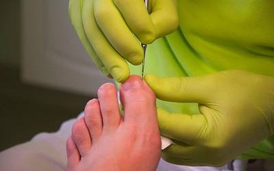 Podologia zerbitzua jarriko dute berriro martxan Aian urtarrilaren 10etik aurrera