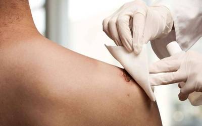 "Batez ere ohean edo gurpildun aulkietan daudenengan gertatzen da"