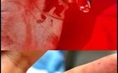 Agintaritzaren agenteekiko erresistentziagatik atxilotuta