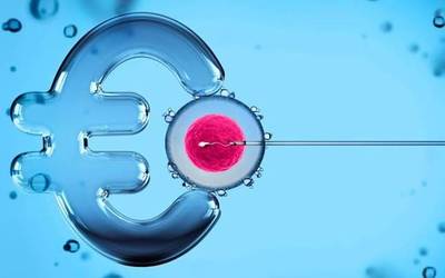 Erreprodukzioa:    eskubidea ala negozioa?